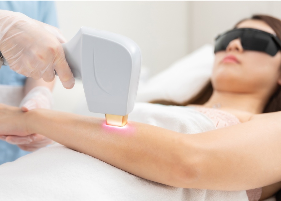 Best hair removal services in Singapore - Japan IPL Express ADLight on arm