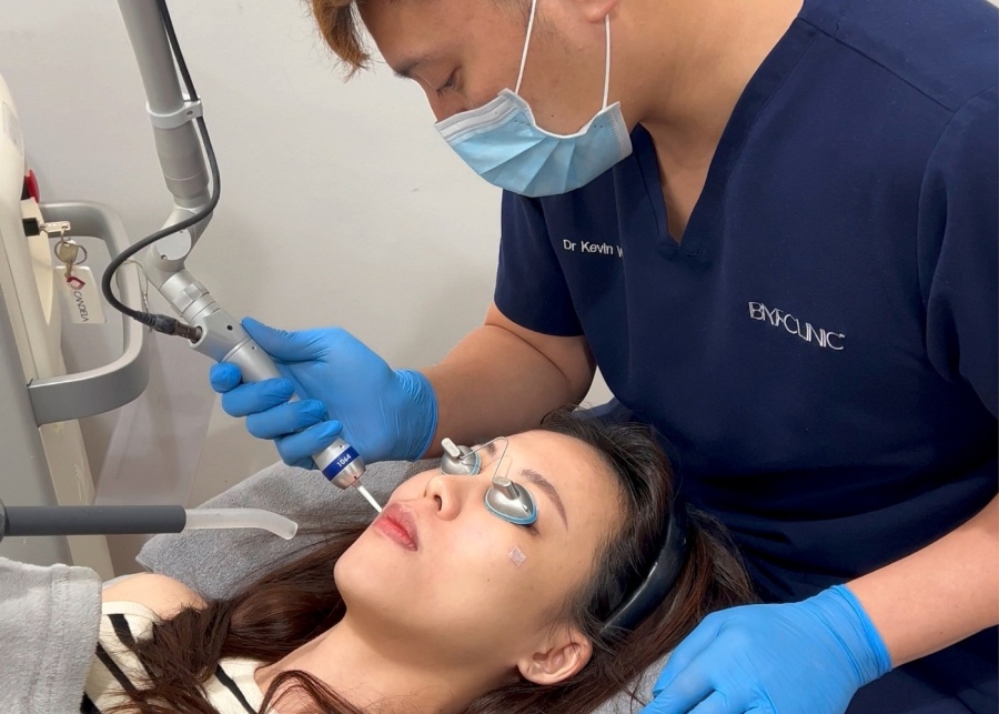 Aesthetic clinics in Singapore - BMF Clinic pico laser
