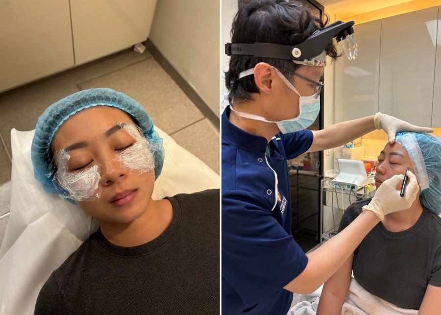 Cambridge Medical Group - Eyebag removal treatment - pre-treatment preparation