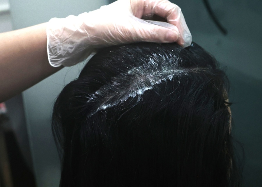 TK TrichoKare Dandruff Defense treatment review - A close-up of the European herbal masque applied on scalp