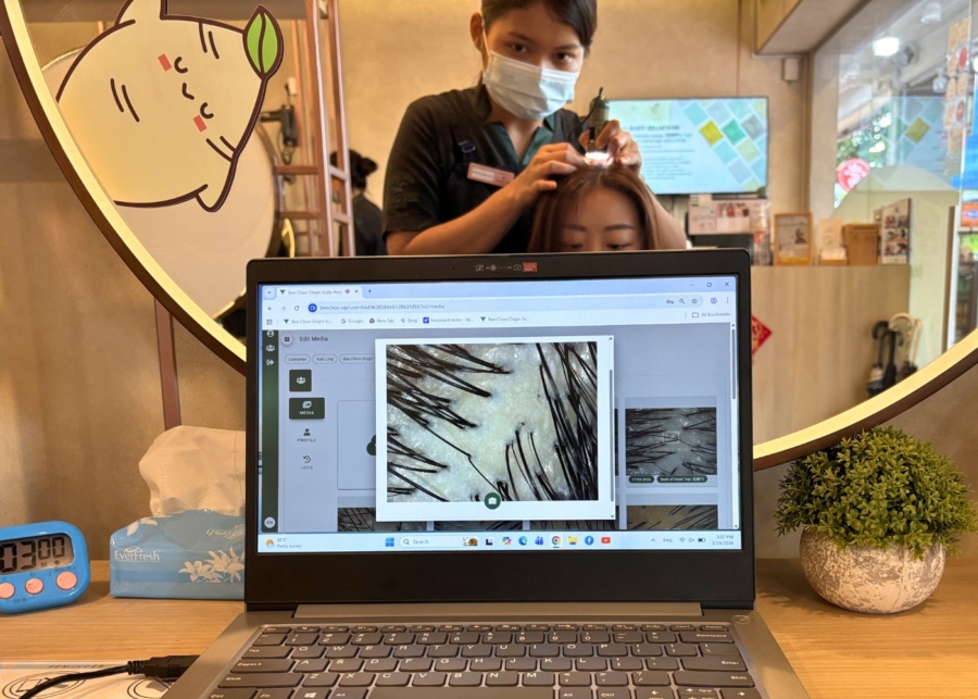 Bee Choo Origin scalp treatment review - Post-treatment scalp scan