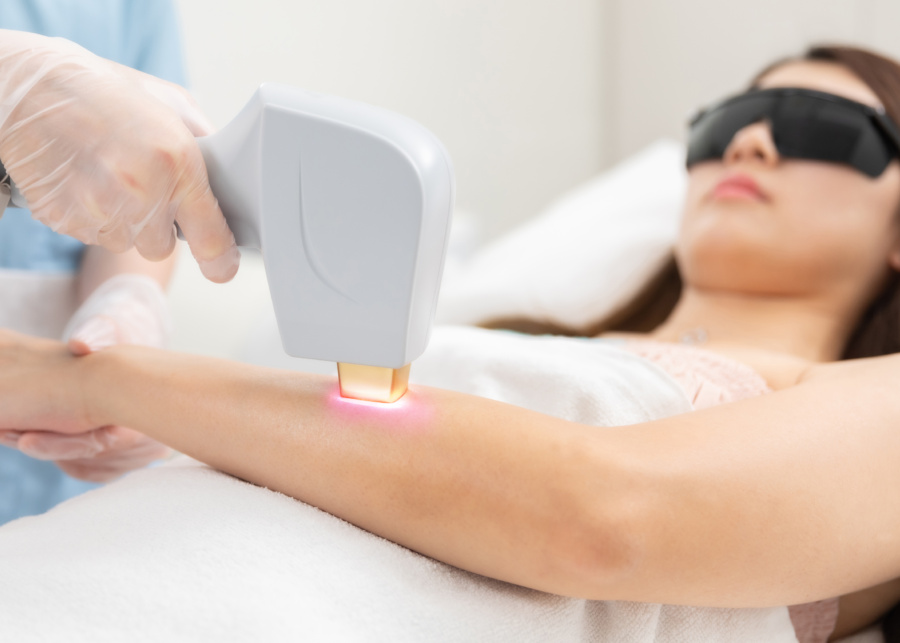 Tired of endless shaving? We found a cheat code at Japan IPL Express for long-lasting permanent hair reduction